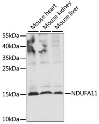 Western Blot: NDUFA11 AntibodyAzide and BSA Free [NBP2-94097]