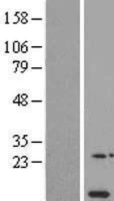 Western Blot: NDUFA11 Overexpression Lysate [NBL1-13536]