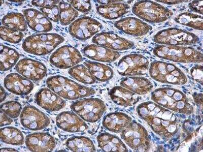 Immunohistochemistry-Paraffin: NDUFA12 Antibody [NBP1-32745]