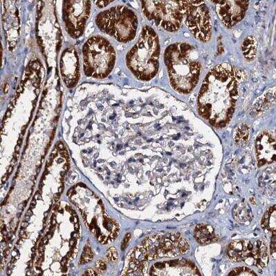 Immunohistochemistry-Paraffin: NDUFA12 Antibody [NBP1-88935]