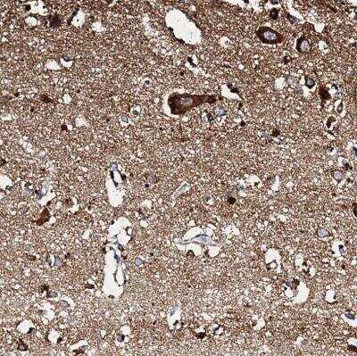 Immunohistochemistry-Paraffin: NDUFA12 Antibody [NBP1-88935]