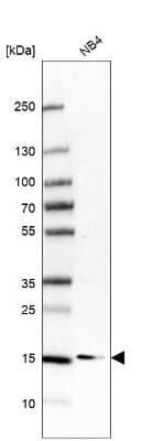 Western Blot: NDUFA12 Antibody [NBP1-88935]