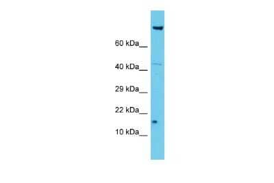 Western Blot: NDUFA12 Antibody [NBP2-85363]