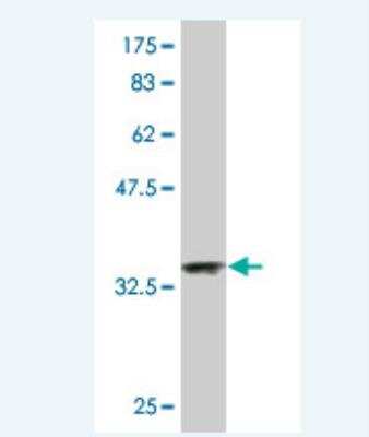 Western Blot: NDUFA2 Antibody (6E7) [H00004695-M01]