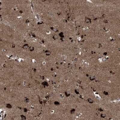 Immunohistochemistry-Paraffin: NDUFA2 Antibody [NBP1-88968]
