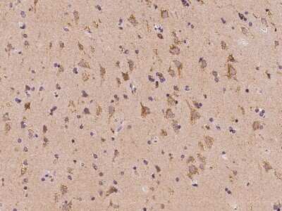 Immunohistochemistry-Paraffin: NDUFA2 Antibody [NBP2-98531]
