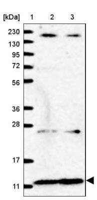 Western Blot: NDUFA2 Antibody [NBP1-88968]