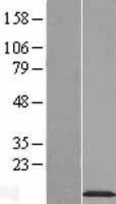 Western Blot: NDUFA2 Overexpression Lysate [NBL1-13539]