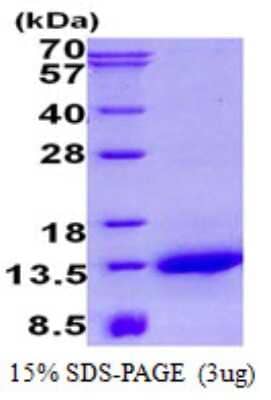 SDS-PAGE: Recombinant Human NDUFA2 His Protein [NBP2-23259]