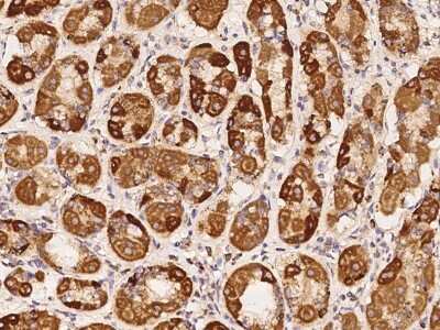 Immunohistochemistry-Paraffin: NDUFA3 Antibody [NBP2-98152]