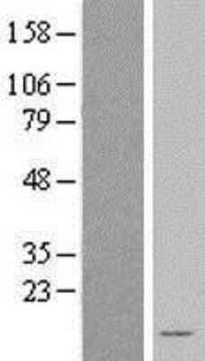 Western Blot: NDUFA3 Overexpression Lysate [NBL1-13540]