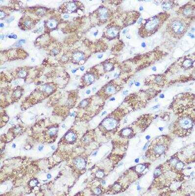 Immunohistochemistry-Paraffin: NDUFA4 Antibody - Azide and BSA Free [NBP2-93390]