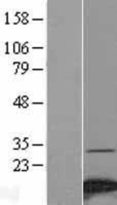 Western Blot: NDUFA4 Overexpression Lysate [NBL1-13541]