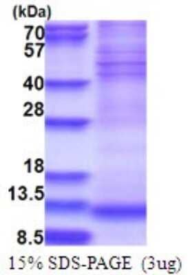 SDS-PAGE: Recombinant Human NDUFA4 His Protein [NBP2-51719]