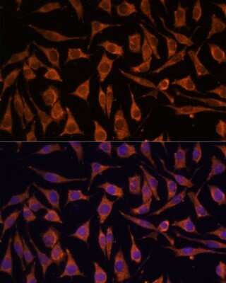 Immunocytochemistry/ Immunofluorescence: NDUFA4L2 Antibody - Azide and BSA Free [NBP2-93831]