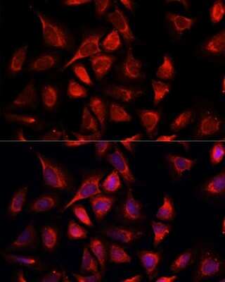 Immunocytochemistry/ Immunofluorescence: NDUFA4L2 Antibody - Azide and BSA Free [NBP2-93831]