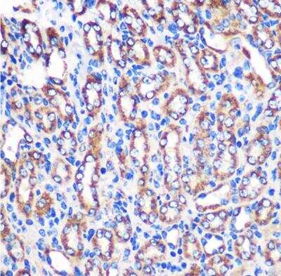 Immunohistochemistry-Paraffin: NDUFA4L2 Antibody - Azide and BSA Free [NBP2-93831]