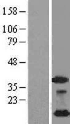 Western Blot: NDUFA4L2 Overexpression Lysate [NBL1-13542]