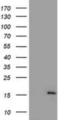 Western Blot: NDUFA5 Antibody (OTI1E8) [NBP2-01454]