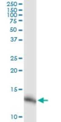 Western Blot: NDUFA5 Antibody (4A2) [H00004698-M02]