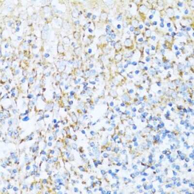 Immunohistochemistry-Paraffin: NDUFA5 Antibody - BSA Free [NBP3-03243]
