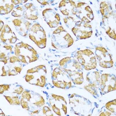 Immunohistochemistry-Paraffin: NDUFA5 Antibody - BSA Free [NBP3-03243]