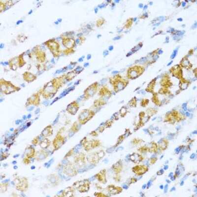 Immunohistochemistry-Paraffin: NDUFA5 Antibody - BSA Free [NBP3-03243]