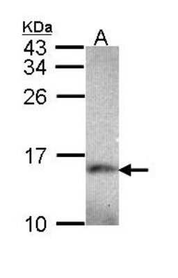 Western Blot: NDUFA5 Antibody [NBP1-33504]