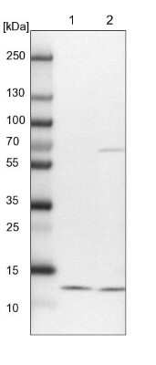 Western Blot: NDUFA5 Antibody [NBP1-88933]