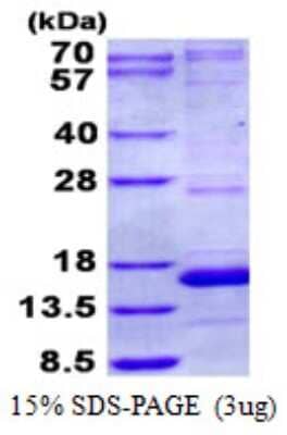 SDS-PAGE: Recombinant Human NDUFA5 His Protein [NBP2-23260]