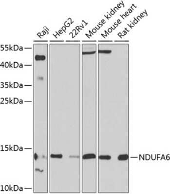 Western Blot: NDUFA6 AntibodyBSA Free [NBP2-93398]