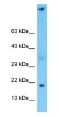 Western Blot: NDUFA6 Antibody [NBP3-09410]