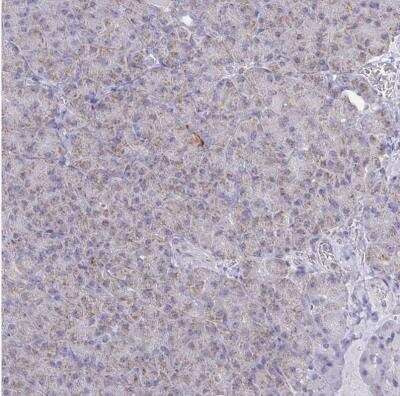 Immunohistochemistry-Paraffin: NDUFA7 Antibody [NBP2-31758]