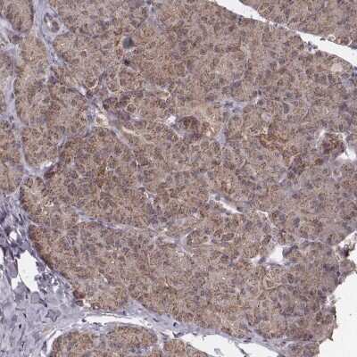 Immunohistochemistry-Paraffin: NDUFA7 Antibody [NBP2-57928]