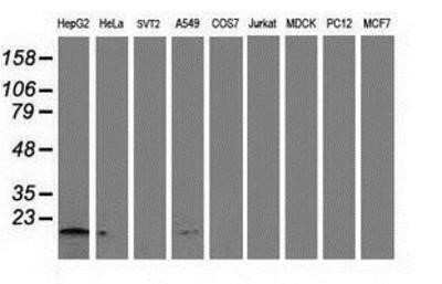 Western Blot: NDUFA7 Antibody (OTI2G4)Azide and BSA Free [NBP2-72909]