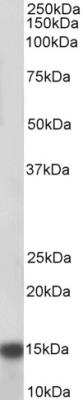 Western Blot: NDUFA7 Antibody [NBP2-26161]