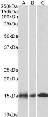 Western Blot: NDUFA7 Antibody [NBP2-26161]