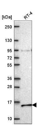 Western Blot: NDUFA7 Antibody [NBP2-57928]