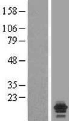 Western Blot: NDUFA7 Overexpression Lysate [NBL1-13544]