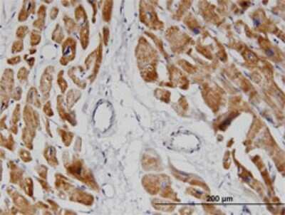 Immunohistochemistry-Paraffin: NDUFA8 Antibody (2E10) [H00004702-M05]