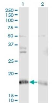 Western Blot: NDUFA8 Antibody (2E10) [H00004702-M05]