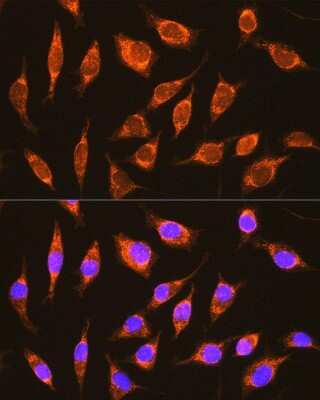 Immunocytochemistry/ Immunofluorescence: NDUFA8 Antibody - Azide and BSA Free [NBP2-93802]