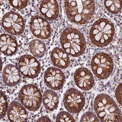 Immunohistochemistry-Paraffin: NDUFA8 Antibody [NBP1-82661]