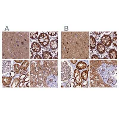 Immunohistochemistry-Paraffin: NDUFA8 Antibody [NBP1-82661]