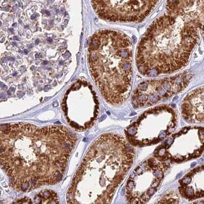 Immunohistochemistry-Paraffin: NDUFA8 Antibody [NBP1-82661]