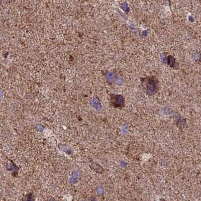 Immunohistochemistry-Paraffin: NDUFA8 Antibody [NBP1-82661]