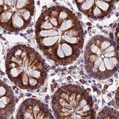 Immunohistochemistry-Paraffin: NDUFA8 Antibody [NBP1-82661]