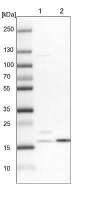 Western Blot: NDUFA8 Antibody [NBP1-82661]