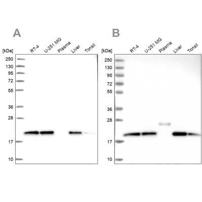 Western Blot: NDUFA8 Antibody [NBP1-82661]