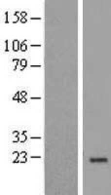 Western Blot: NDUFA8 Overexpression Lysate [NBL1-13545]